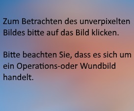 OP-und Wundbild verpixelt