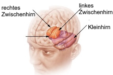 Zwichenhirn Diencephalon