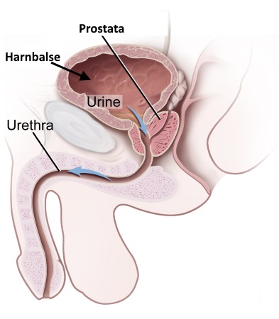 normale Prostata