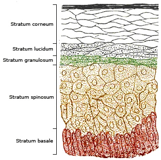 Epidermis bei Schuppenflechte