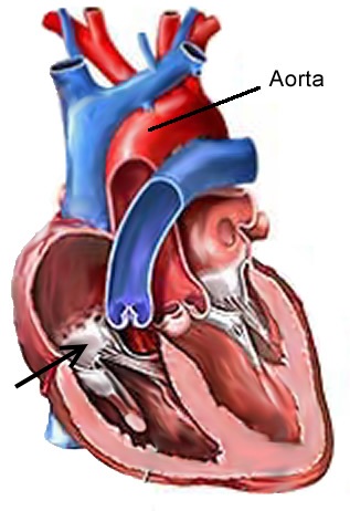 Tricuspidalklappe