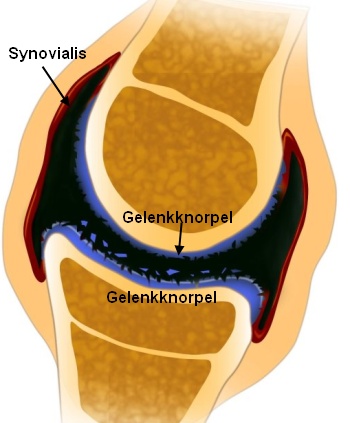 Gelenk-Aufbau