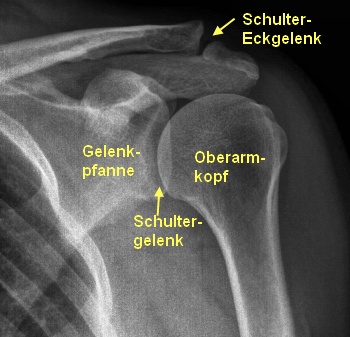 Kugelgelenk - Aufbau, Funktion & Krankheiten