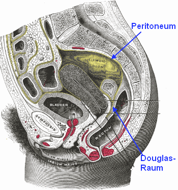 Douglas - Raum (Douglas-Zeichen)