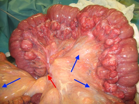 Volvolus: mechanischer Ileus