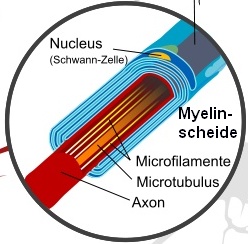Waller-Degeneration (Nervenhülle)