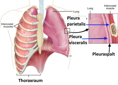 Pleuraspalt und Lunge